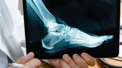 Orthopedic surgeons performing a joint replacement procedure in a hospital operating room
