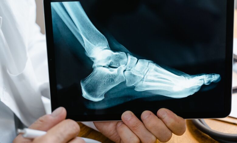 Orthopedic surgeons performing a joint replacement procedure in a hospital operating room