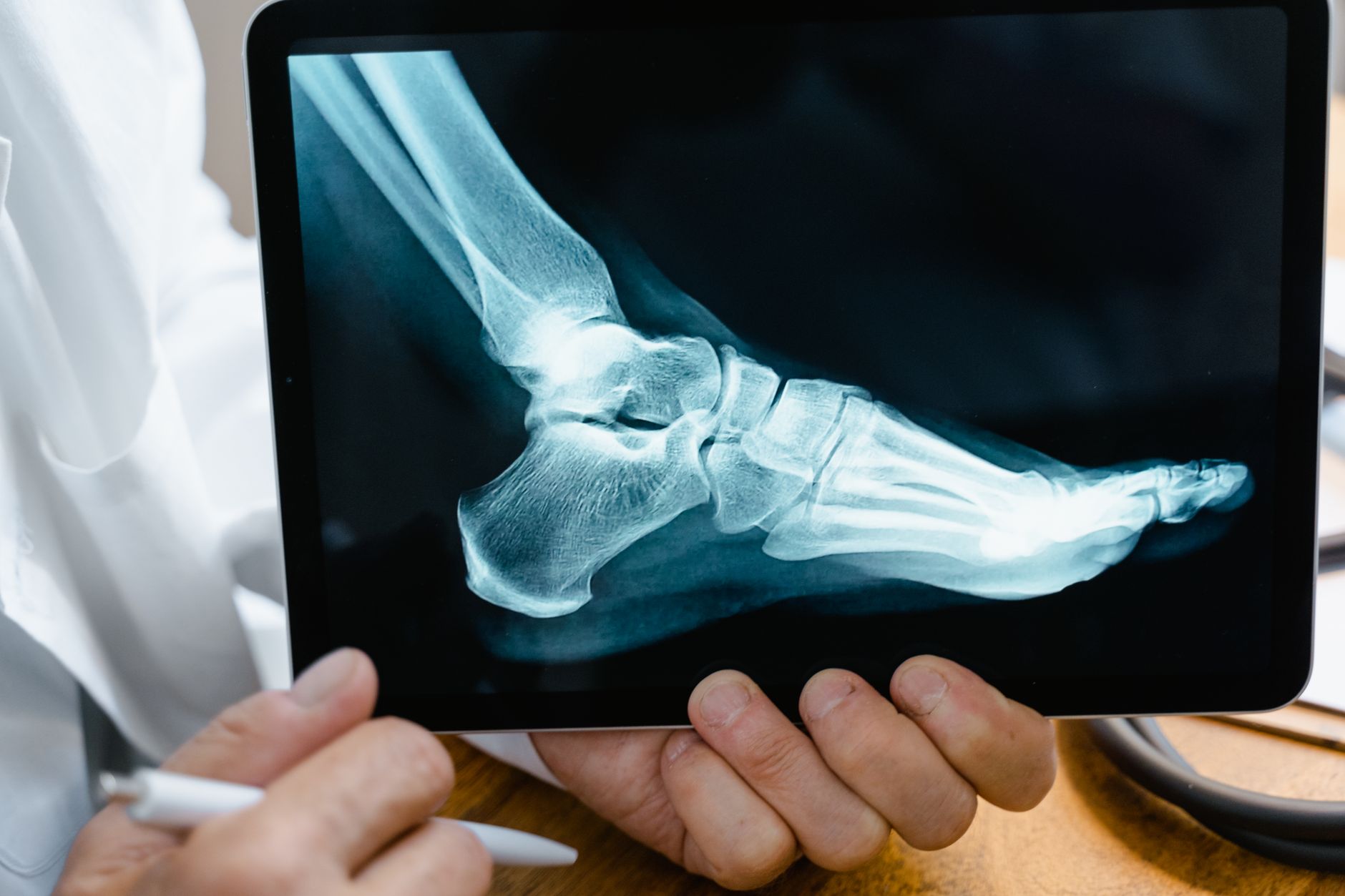 Orthopedic surgeons performing a joint replacement procedure in a hospital operating room