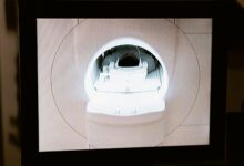A large MRI machine inside a hospital imaging suite