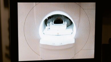 A large MRI machine inside a hospital imaging suite