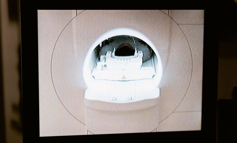 A large MRI machine inside a hospital imaging suite