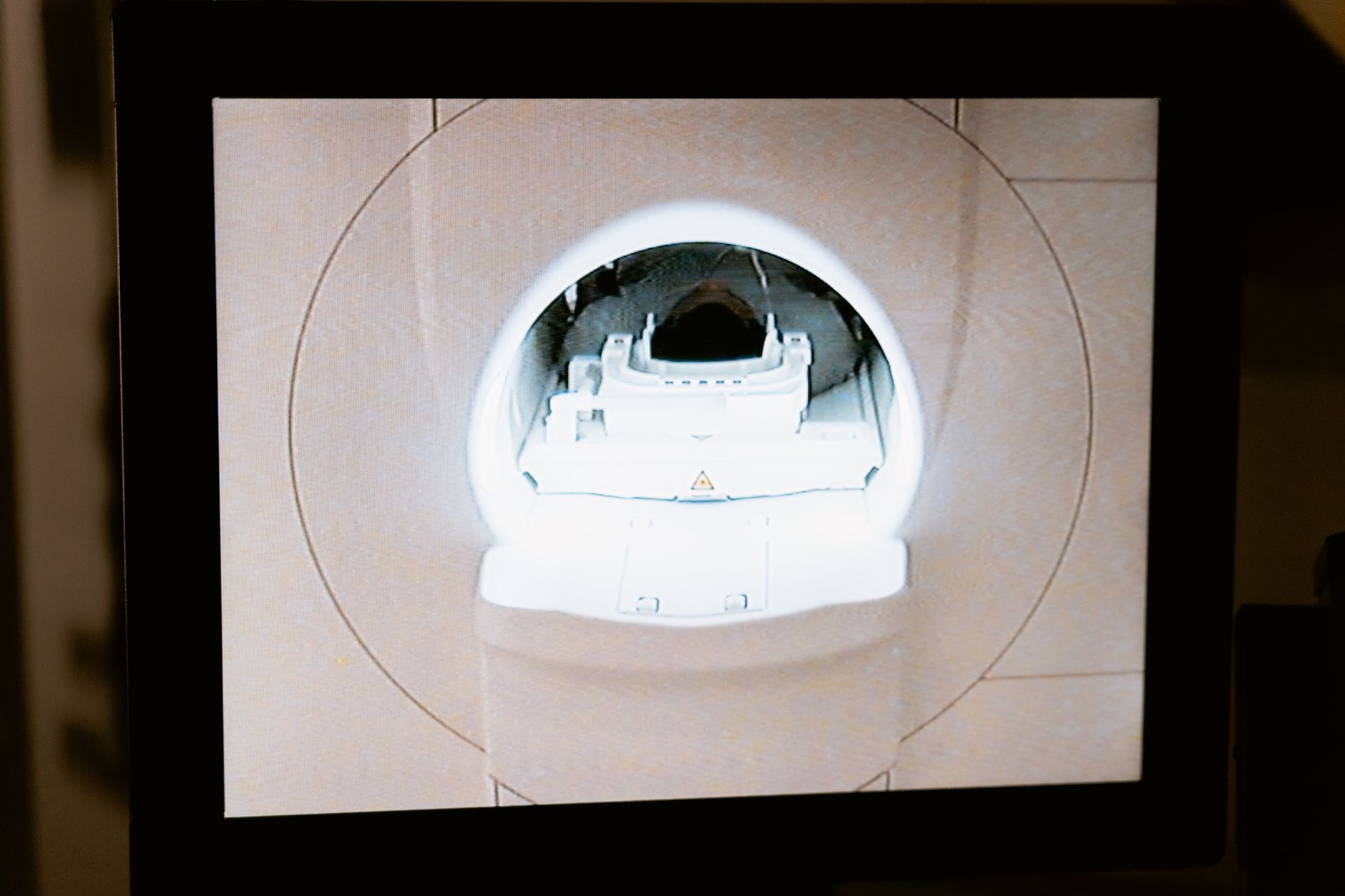 A large MRI machine inside a hospital imaging suite